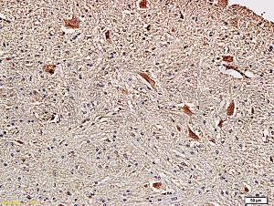 Anti-FSCN1 Rabbit Polyclonal Antibody