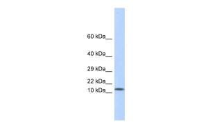 Anti-LGALS1 Rabbit Polyclonal Antibody