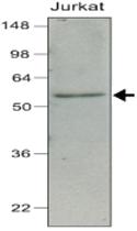 Anti-IRF7 Mouse Monoclonal Antibody [clone: 3D9]