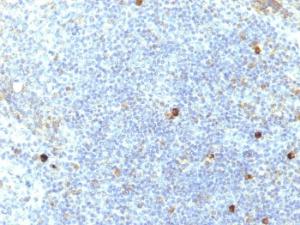 Immunohistochemical analysis of formalin-fixed, paraffin-embedded human tonsil using Anti-HLA Aw32 + HLA A25 Antibody [SPM417]