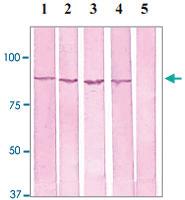 Anti-CTNNB1 Rabbit Polyclonal Antibody