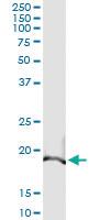 Anti-BAK Antibody Pair