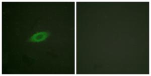 Immunofluorescence analysis of HeLa cells using Anti-Annexin A6 Antibody The right hand panel represents a negative control, where the antibody was pre-incubated with the immunising peptide