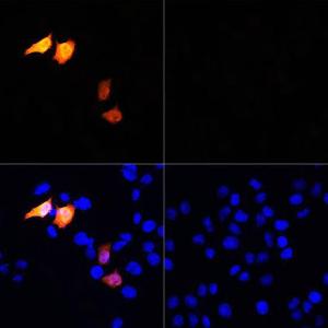 Immunofluorescence analysis of HeLa cells using Anti-His Tag Antibody (A306183) at a dilution of 1:100. DAPI was used to stain the cell nuclei (blue).