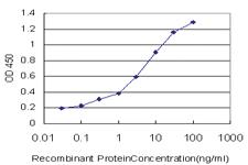 Anti-ACSL1 Mouse Monoclonal Antibody [clone: 3G4]