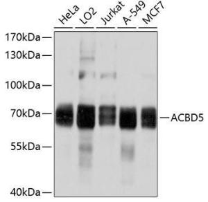 Antibody anti-ACBD5 100 µl