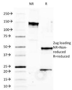 SDS-PAGE analysis of Anti-HLA B Antibody [JOAN-1] under non-reduced and reduced conditions; showing intact IgG and intact heavy and light chains, respectively. SDS-PAGE analysis confirms the integrity and purity of the antibody.