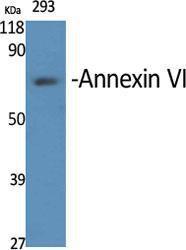 Western blot analysis of various cells using Anti-Annexin A6 Antibody