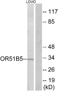 Western blot analysis of lysates from LOVO cells using Anti-OR51B5 Antibody. The right hand lane represents a negative control, where the antibody is blocked by the immunising peptide.