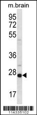 Anti-SIGMAR1 Rabbit Polyclonal Antibody