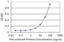 Anti-MLLT6 Mouse Monoclonal Antibody [clone: 1B2]