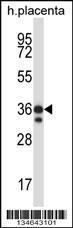 Anti-Mst4 Rabbit Polyclonal Antibody (APC (Allophycocyanin))