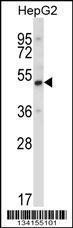 Anti-UBP1 Rabbit Polyclonal Antibody (HRP (Horseradish Peroxidase))