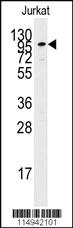 Anti-ADCY2 Rabbit Polyclonal Antibody