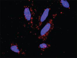 Anti-MAX + MSH2 Antibody Pair