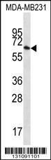 Anti-GBP1 Rabbit Polyclonal Antibody (PE (Phycoerythrin))