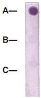 Anti-CTNNB1 Rabbit Polyclonal Antibody