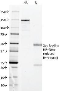 SDS-PAGE analysis of Anti-HLA DP Antibody [BRA-FB6] under non-reduced and reduced conditions; showing intact IgG and intact heavy and light chains, respectively. SDS-PAGE analysis confirms the integrity and purity of the antibody