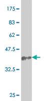 Anti-SNAI2 Mouse Monoclonal Antibody [clone: 2F11]