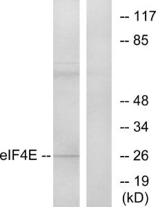 Anti-eIF4E antibody