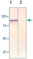 Anti-CTNNB1 Rabbit Polyclonal Antibody