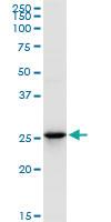 Anti-UROS Rabbit Polyclonal Antibody