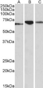 Anti-PDIA2 Antibody (A84953) (0.1 µg/ml) staining of Human (A), Mouse (B) and Rat (C) Pancreas lysates (35 µg protein in RIPA buffer). Primary incubation was 1 hour. Detected by chemiluminescence