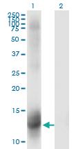 Anti-NR3C2 Mouse Monoclonal Antibody [clone: 2B5]