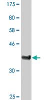 Anti-CDS1 Mouse Monoclonal Antibody [clone: 2D10]