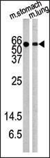 Anti-AKT1 Rabbit Polyclonal Antibody (Biotin)