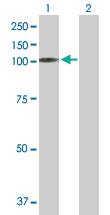 Anti-MAST2 Mouse Polyclonal Antibody