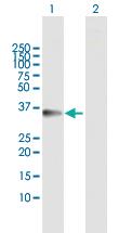 Anti-TTC1 Rabbit Polyclonal Antibody