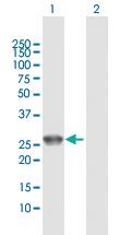 Anti-UROS Rabbit Polyclonal Antibody