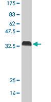 Anti-ALK Mouse Polyclonal Antibody