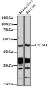 Anti-CYP7A1 Antibody (A8675)