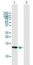 Anti-HCP5 Mouse Polyclonal Antibody