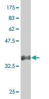 Anti-SNAI2 Mouse Monoclonal Antibody [clone: 4D11]