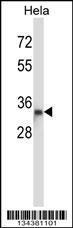 Anti-DTNBP1 Rabbit Polyclonal Antibody (HRP (Horseradish Peroxidase))