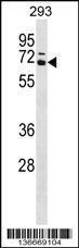 Anti-CARM1 Rabbit Polyclonal Antibody (Biotin)