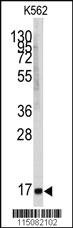 Anti-MGST1 Rabbit Polyclonal Antibody