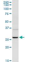 Anti-UROS Rabbit Polyclonal Antibody