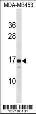 Anti-LIM2 Rabbit Polyclonal Antibody (PE (Phycoerythrin))