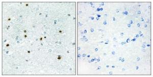 Immunohistochemical analysis of paraffin-embedded human brain using Anti-DCLK3 Antibody The right hand panel represents a negative control, where the antibody was pre-incubated with the immunising peptide