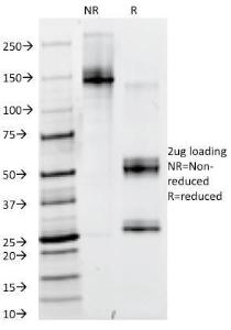 SDS-PAGE analysis of Anti-PAX6 Antibody [PAX6/498] under non-reduced and reduced conditions; showing intact IgG and intact heavy and light chains, respectively. SDS-PAGE analysis confirms the integrity and purity of the antibody