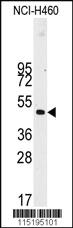 Anti-MECP2 Rabbit Polyclonal Antibody