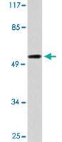 Anti-HTR2B Rabbit Polyclonal Antibody