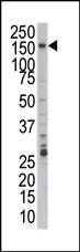 Anti-PRPF4B Rabbit Polyclonal Antibody (HRP (Horseradish Peroxidase))