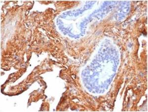 Immunohistochemical analysis of formalin-fixed, paraffin-embedded human lung using Anti-Fibronectin Antibody [FN1/3569] at 2 µg/ml in PBS for 30  minutes at room temperature