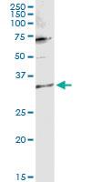 Anti-TTC1 Rabbit Polyclonal Antibody