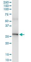 Anti-UROS Rabbit Polyclonal Antibody